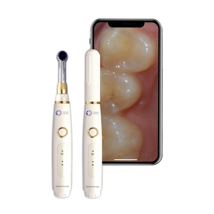 Smart Dental Scope Instant Dentist
