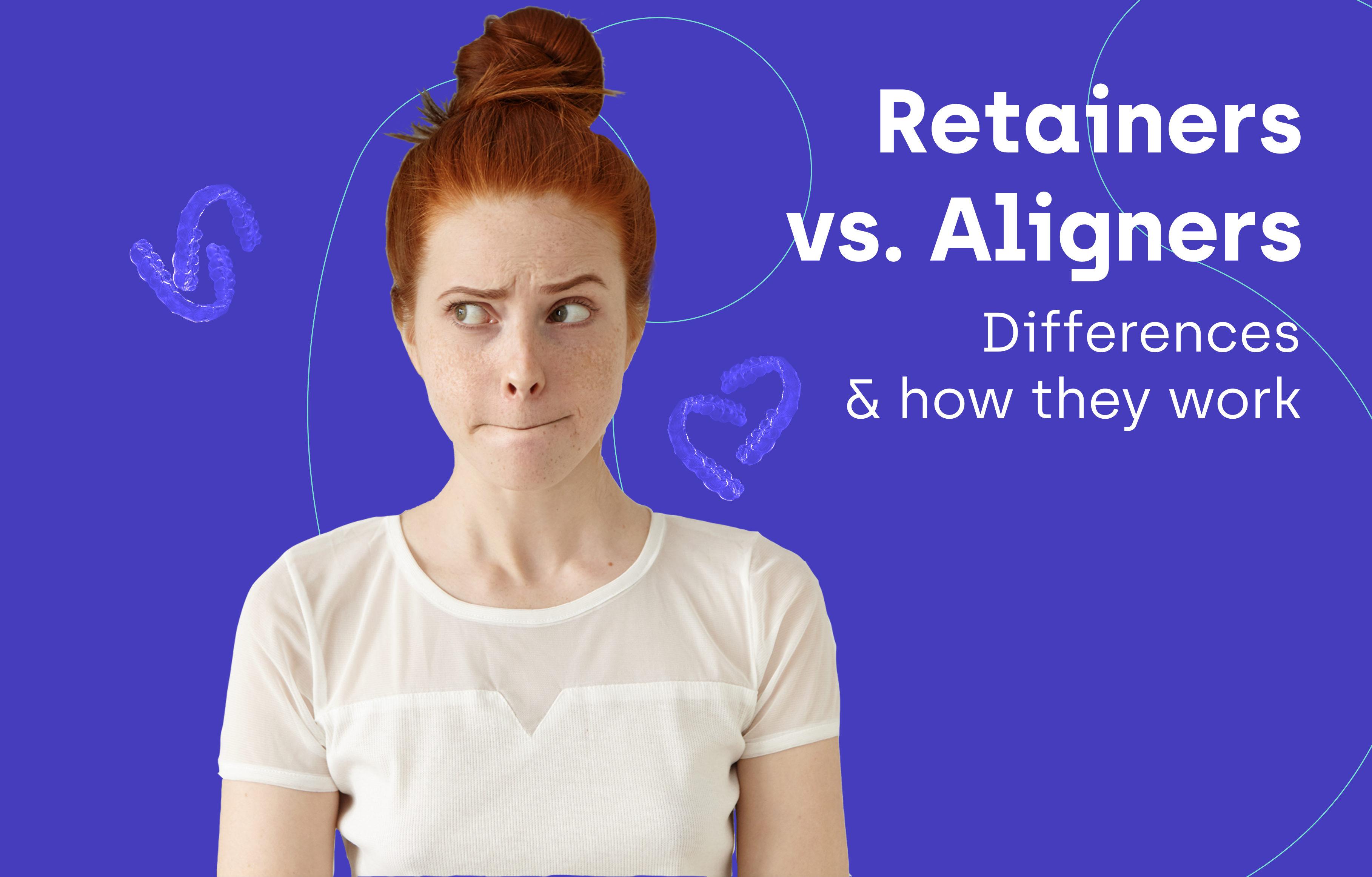 retainers vs aligners